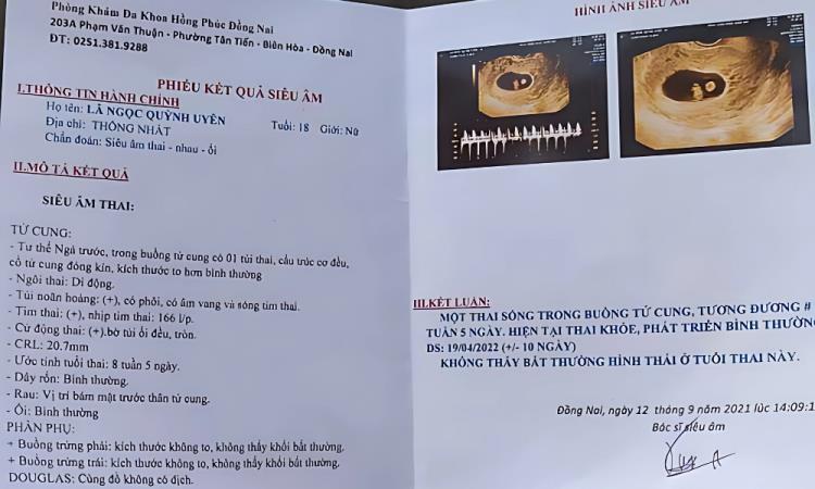 Giấy tờ cần thiết khi mang thai đi máy bay