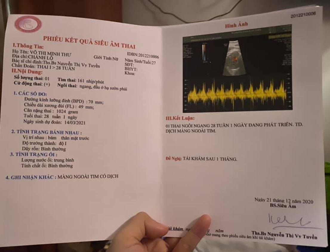 Phiếu siêu âm chứng minh tuần thai được mang theo khi bay